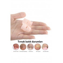 Shelax 1 Pair Silicone Ingrown Toenail Correction Tool Invisible Ingrown Toe Nail Care Elastic Straightening Clip Brace