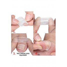 Shelax 1 Pair Silicone Ingrown Toenail Correction Tool Invisible Ingrown Toe Nail Care Elastic Straightening Clip Brace
