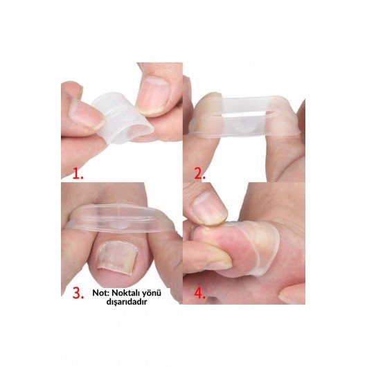 Shelax 1 Pair Silicone Ingrown Toenail Correction Tool Invisible Ingrown Toe Nail Care Elastic Straightening Clip Brace